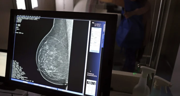 Carreta oferece mamografias gratuitas em cidades da Bahia com baixa cobertura